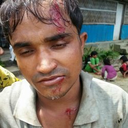 لاجئو الروهنغيا يتحدثون عن أعمال عنف جديدة ودعوات لفرض عقوبات على ميانمار