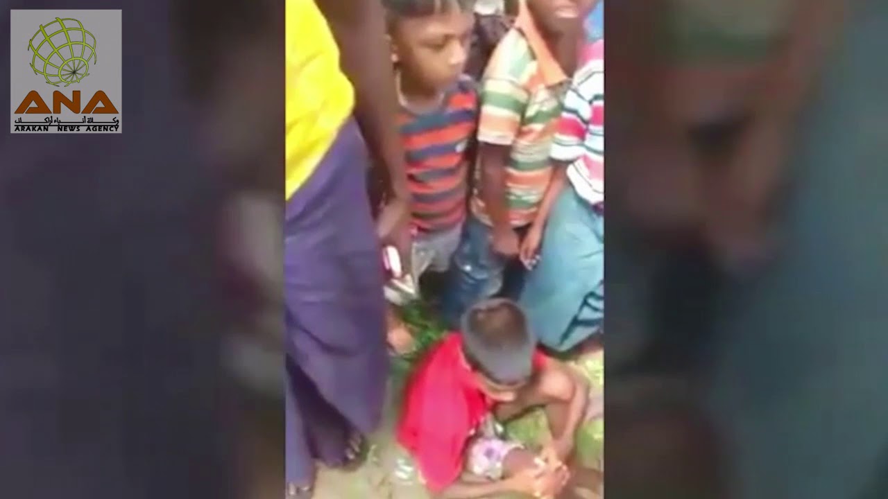 شاهد: طفل روهنغي مصاب برصاص من الجيش الميانماري