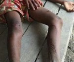 ‘المدافعين عن حقوق الانسان’ تطالب الجنائية الدولية بالتحقيق في جرائم بورما