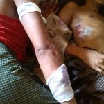 القوات البورمية تعتقل شابا روهنجيا وتعذبه في المعتقل