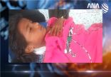 مصرع طفلين وإصابة آخر من الروهنغيا في انفجار لغم أرضي بولاية أراكان