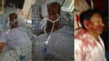 وفاة ناشط روهنغي متأثرا بجراحه في حادث مروري ببنجلاديش