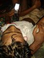 إصابة روهنجي برصاصة في بنغلاديش تدخله حالة حرجة