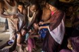 أوجاع «الروهنغيا» داخل مستشفى الناجين في بنغلادش