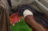 إصابة شاب روهنغي في معارك البوذيين والجيش الحكومي