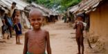 الموت جوعًا يطارد لاجئي الروهينجيا في بنجلاديش