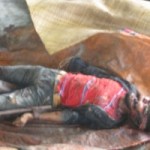 وفاة طفل ورهنجي وإصابة آخر في مخيم “باوكتاو” بأراكان