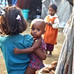 سوء التغذية يودي بحياة طفلة روهنجية في بنغلاديش